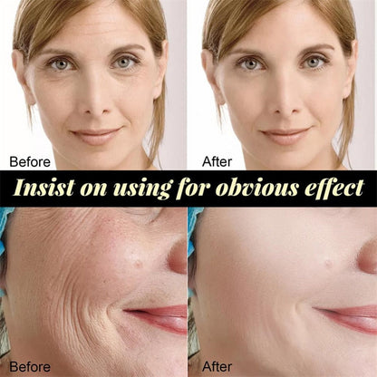 Absorbable Anti-Aging Facial Serum Collagen Wrinkle Remove