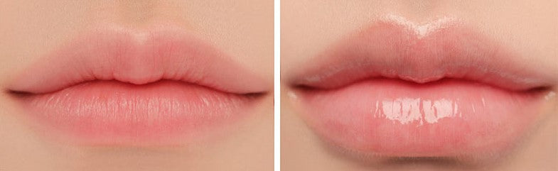 💋The Original Vitamin E Lip™ Serum for Soft and Supple Lips!