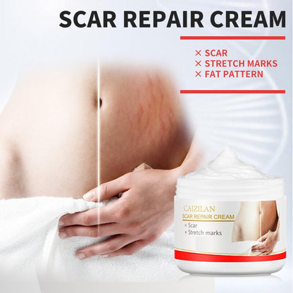 Scar Repair Cream AcnePregnant Stretch Marks Removal Fat Striae Gravidarum 30g