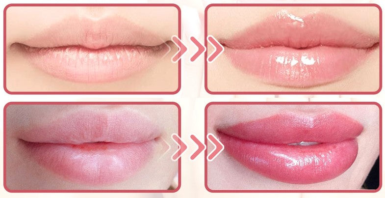 💋The Original Vitamin E Lip™ Serum for Soft and Supple Lips!
