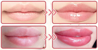 💋The Original Vitamin E Lip™ Serum for Soft and Supple Lips!