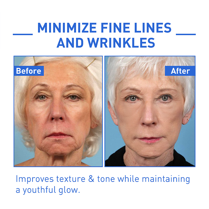 Youthfully™ Botox Face Serum