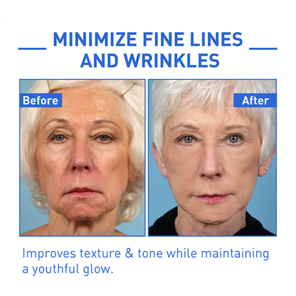 Youthfully™ Botox Face Serum