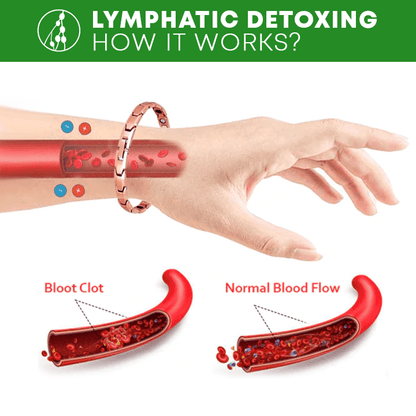 Lymph Detox Bracelet