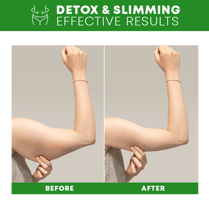 Lymph Detox Bracelet