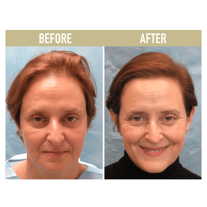 Palms™ Anti-Hair Loss Rice Shampoo Soap
