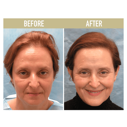 Palms™ Anti-Hair Loss Rice Shampoo Soap