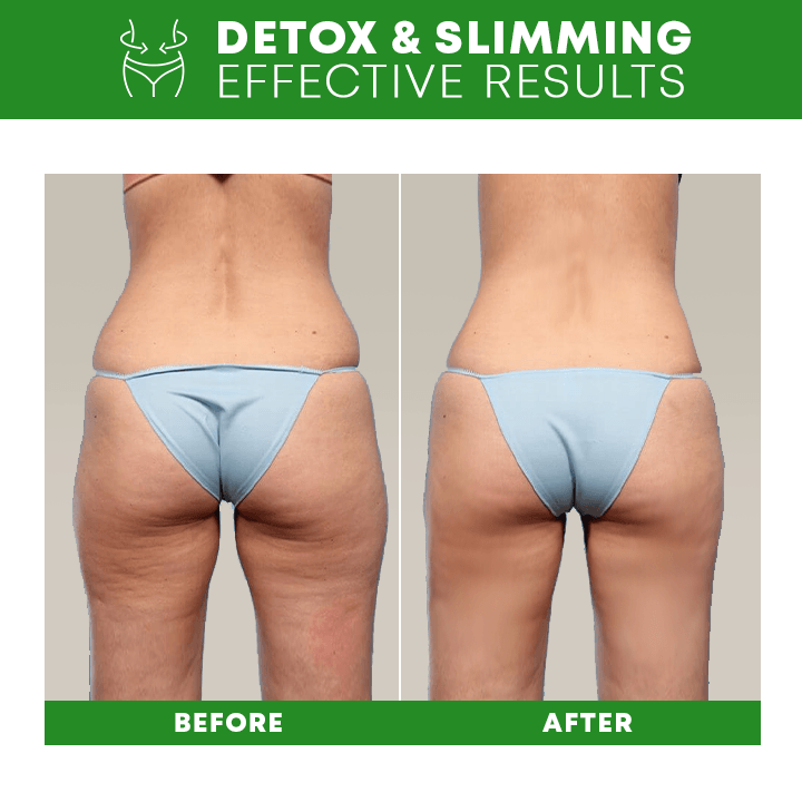 Lymph Detox Bracelet