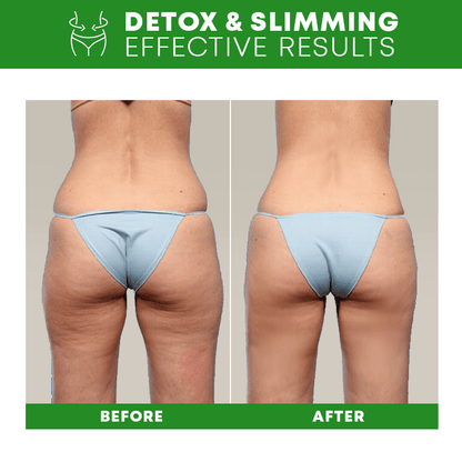 Lymph Detox Bracelet