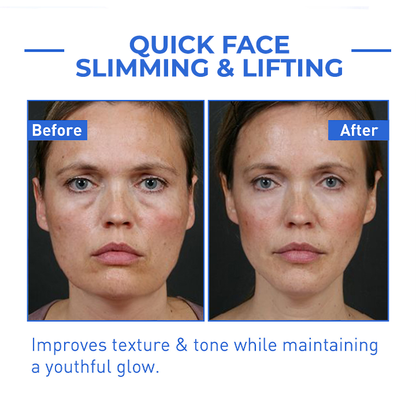 Youthfully™ Botox Face Serum