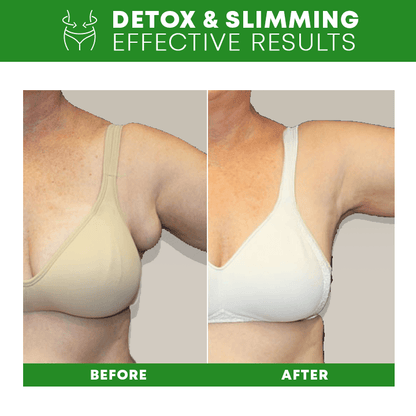 Lymph Detox Bracelet