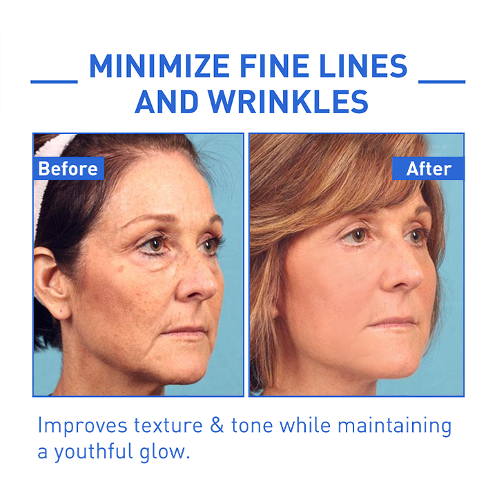 Youthfully™ Botox Face Serum
