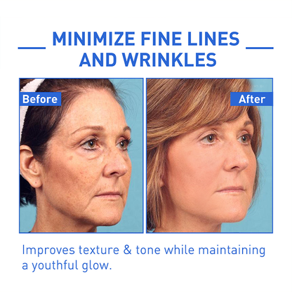 Youthfully™ Botox Face Serum