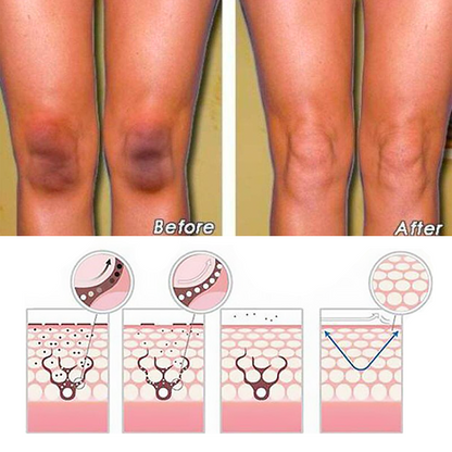 BioLap™ Dark Spot Correcting Cream