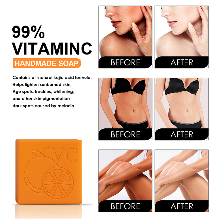 Elements™ Vitamin C Whitening Soap