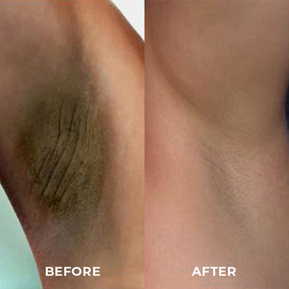 BioLap™ Dark Spot Correcting Cream