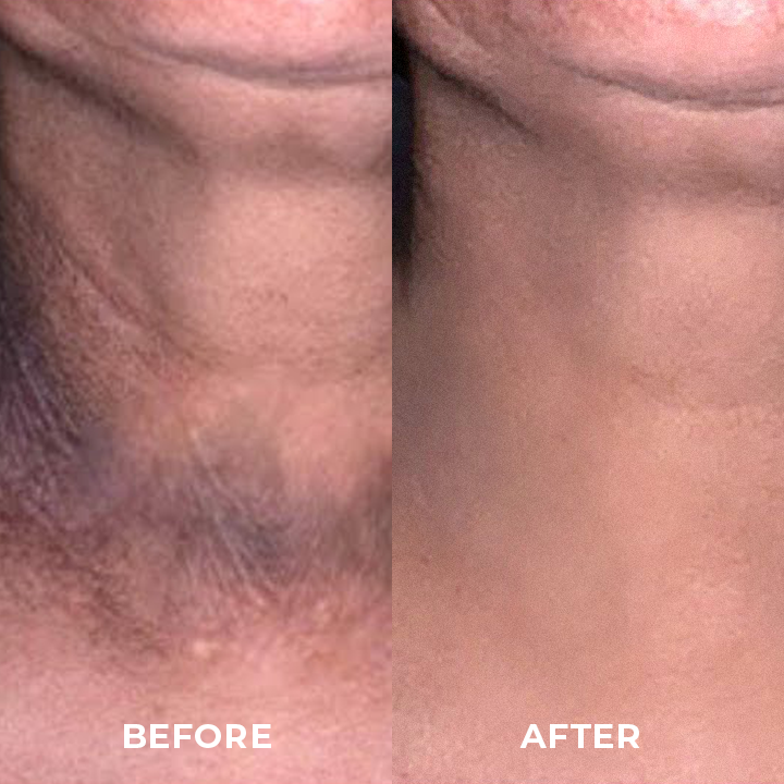 BioLap™ Dark Spot Correcting Cream