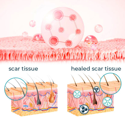 Bioskin™ Advanced Scar Removal Gel